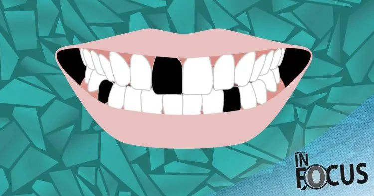 The shocking reason people are pulling out their own teeth